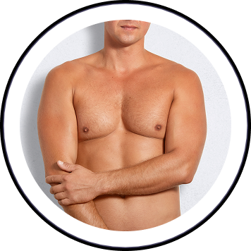 A ginecomastia pode ser hereditária